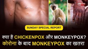 Monkeypox Virus Hindi Symptoms, Prevention, Treatment