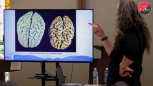 By 2060, 1 Million Americans Could Be Diagnosed with Dementia Annually