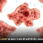 ब्रेन-ईटिंग अमीबा