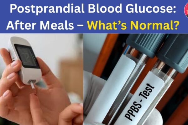 Postprandial Blood Glucose After Meals – What’s Normal