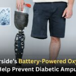 UC Riverside’s Battery-Powered Oxygen Gel Could Help Prevent Diabetic Amputations