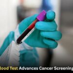 MCED Blood Test Advances Cancer Screening Debate