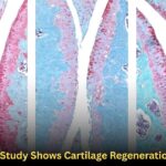 Stanford Study Shows Cartilage Regeneration in Mice