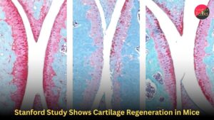Stanford Study Shows Cartilage Regeneration in Mice