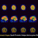Alzheimer’s Treatment Hope: Sox9 Protein Helps Astrocytes Clear Brain Plaques